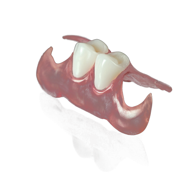 فلیپر متحرک (جایگزین ایمپلنت)